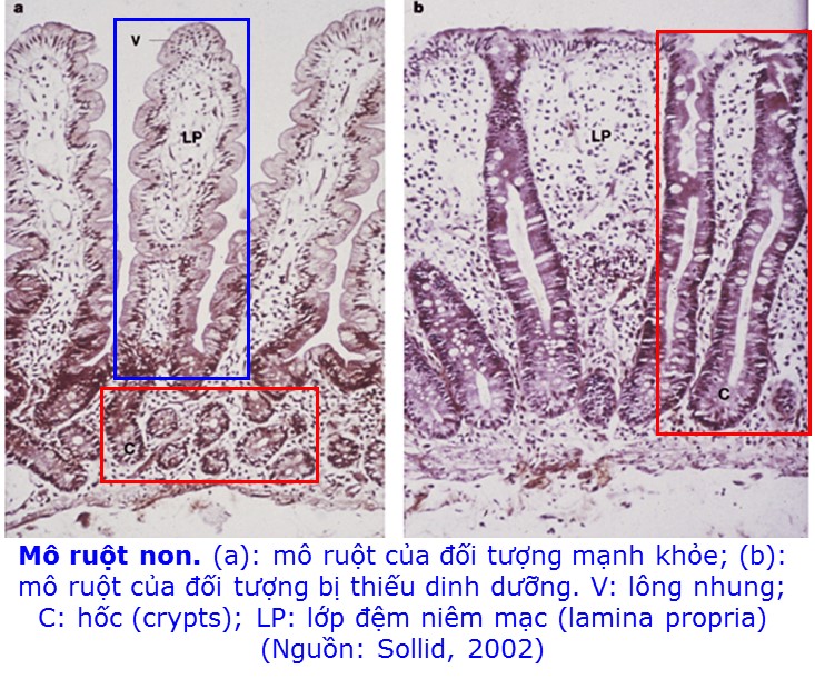 Biểu mô ruột non: Cấu trúc và vai trò quan trọng trong tiêu hóa